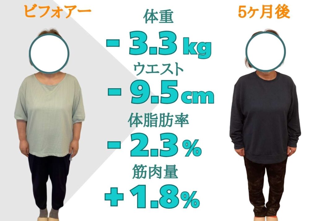 ダイエット指導を受けた患者様のビフォーアフター写真（顔は丸で非表示）。5ヶ月後に体重-3.3kg、ウエスト-9.5cm、体脂肪率-2.3%、筋肉量+1.8%という変化を示す画像 