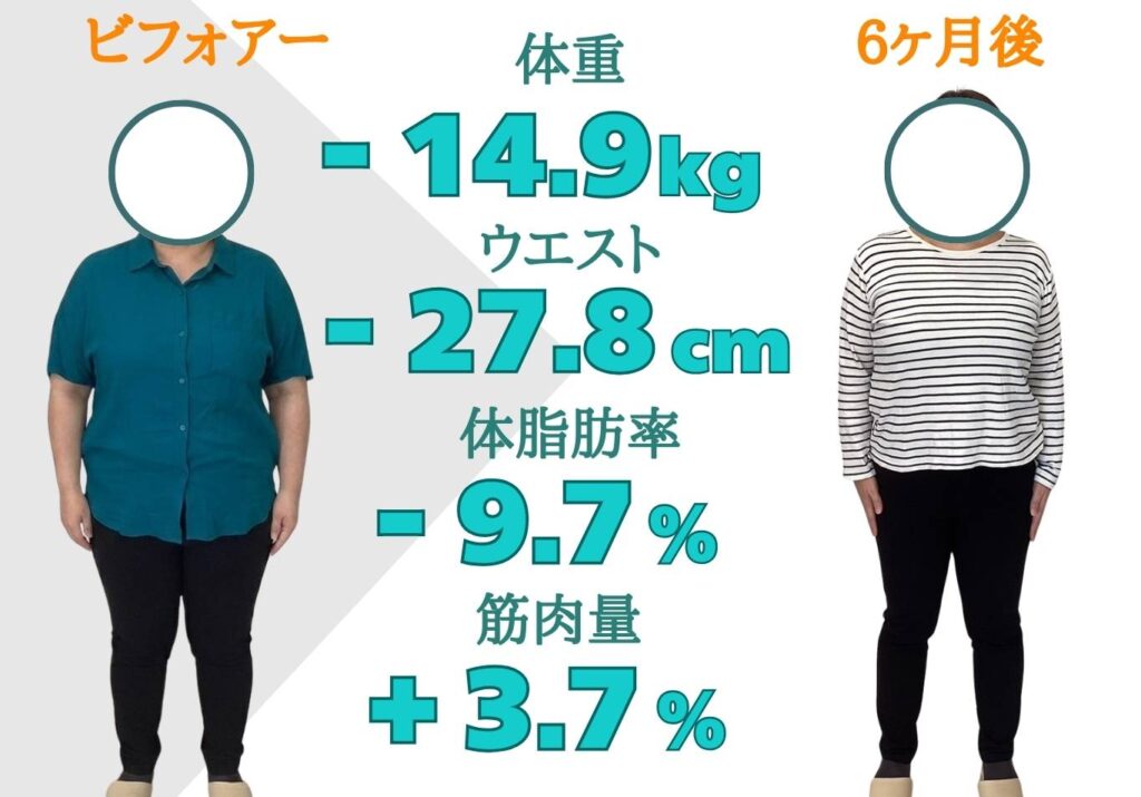ダイエット指導を受けた患者様のビフォーアフター写真（顔は丸で非表示）。4ヶ月後に体重-4.4kg、ウエスト-8.7cm、体脂肪率-2.9%、筋肉量+1.1%という変化を示す画像