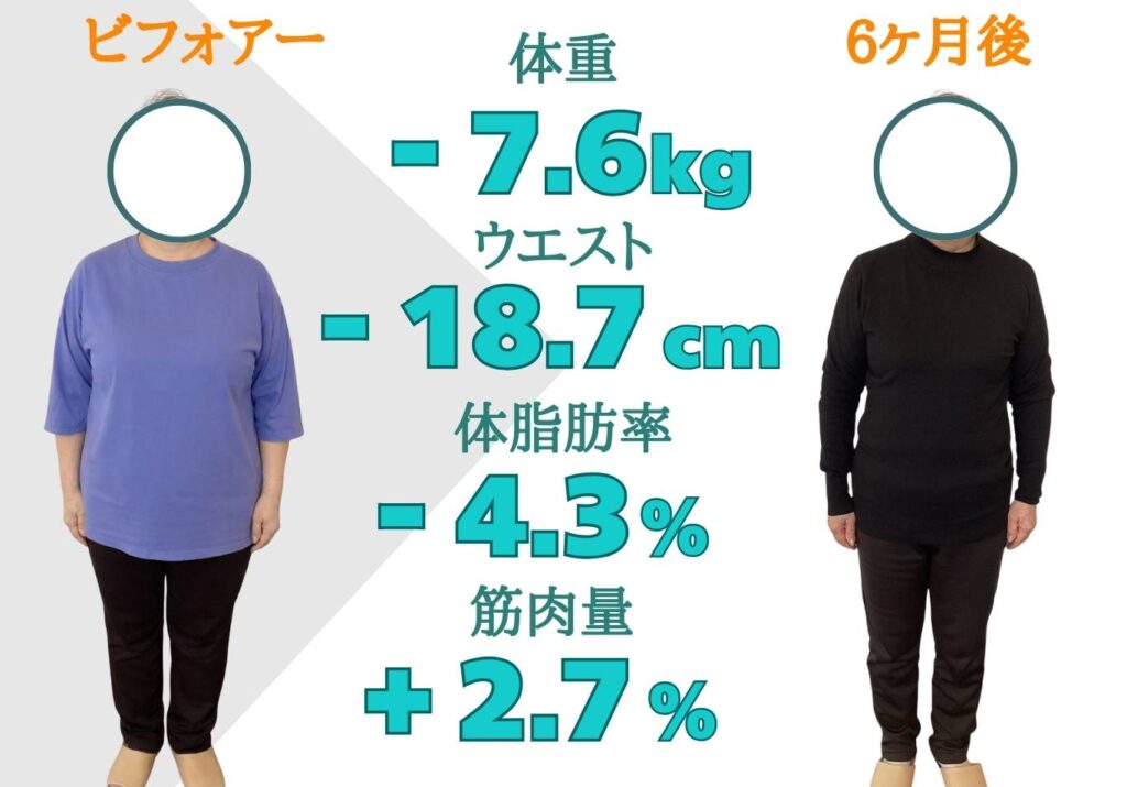 ダイエットとトレーニング指導を受けた患者様のビフォーアフター写真（顔は丸で非表示）。6ヶ月後に体重-7.6kg、ウエスト-18.7cm、体脂肪率-4.3%、筋肉量+2.7%という変化を示す画像 