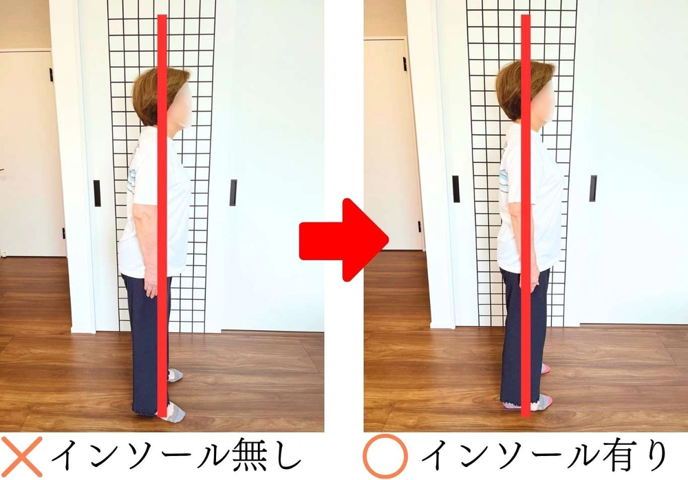 インソールを入れていないときと入れたときの立ち姿勢を、同じ女性を横から撮った写真で比べた画像。体の横に赤い基準線が引かれていて、姿勢が良くなっているのがわかる
